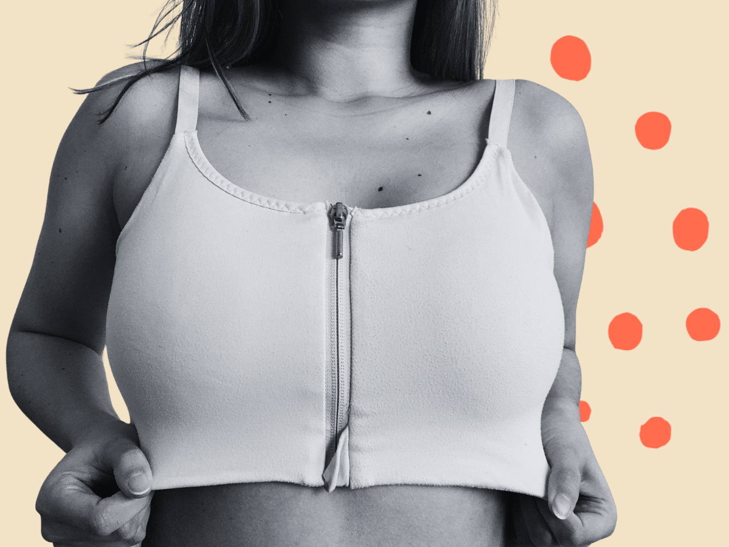 2 techniques for overcoming Iron Bra syndrome, The Mastectomy Guide was  live.