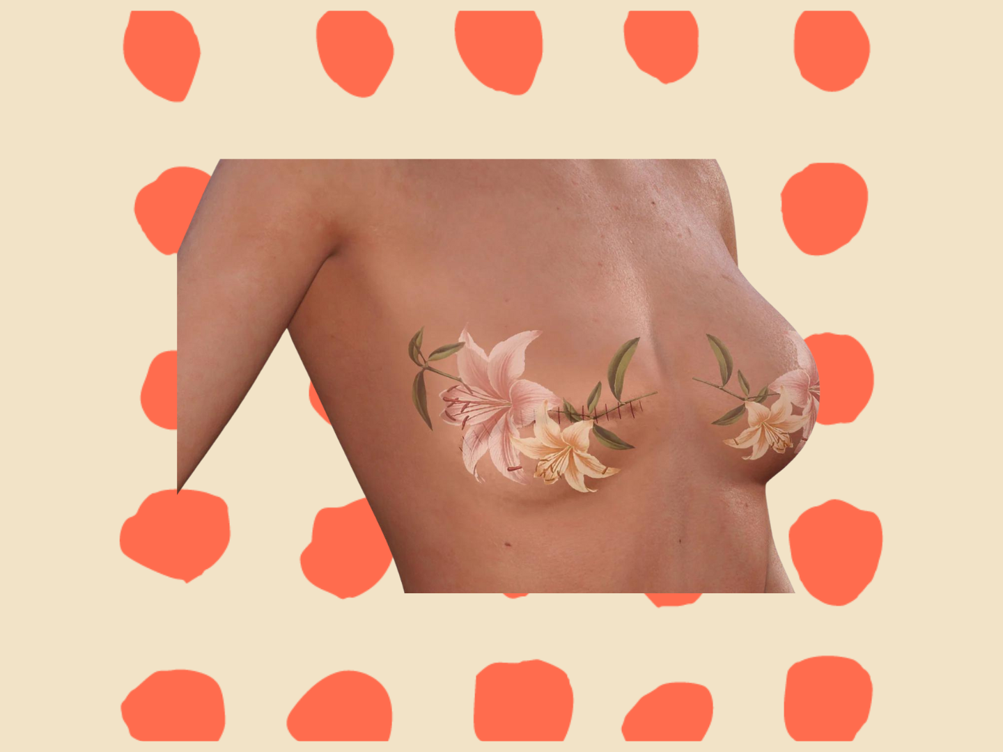 A chest with mastectomy scars covered by temporary tattoos of lilies.