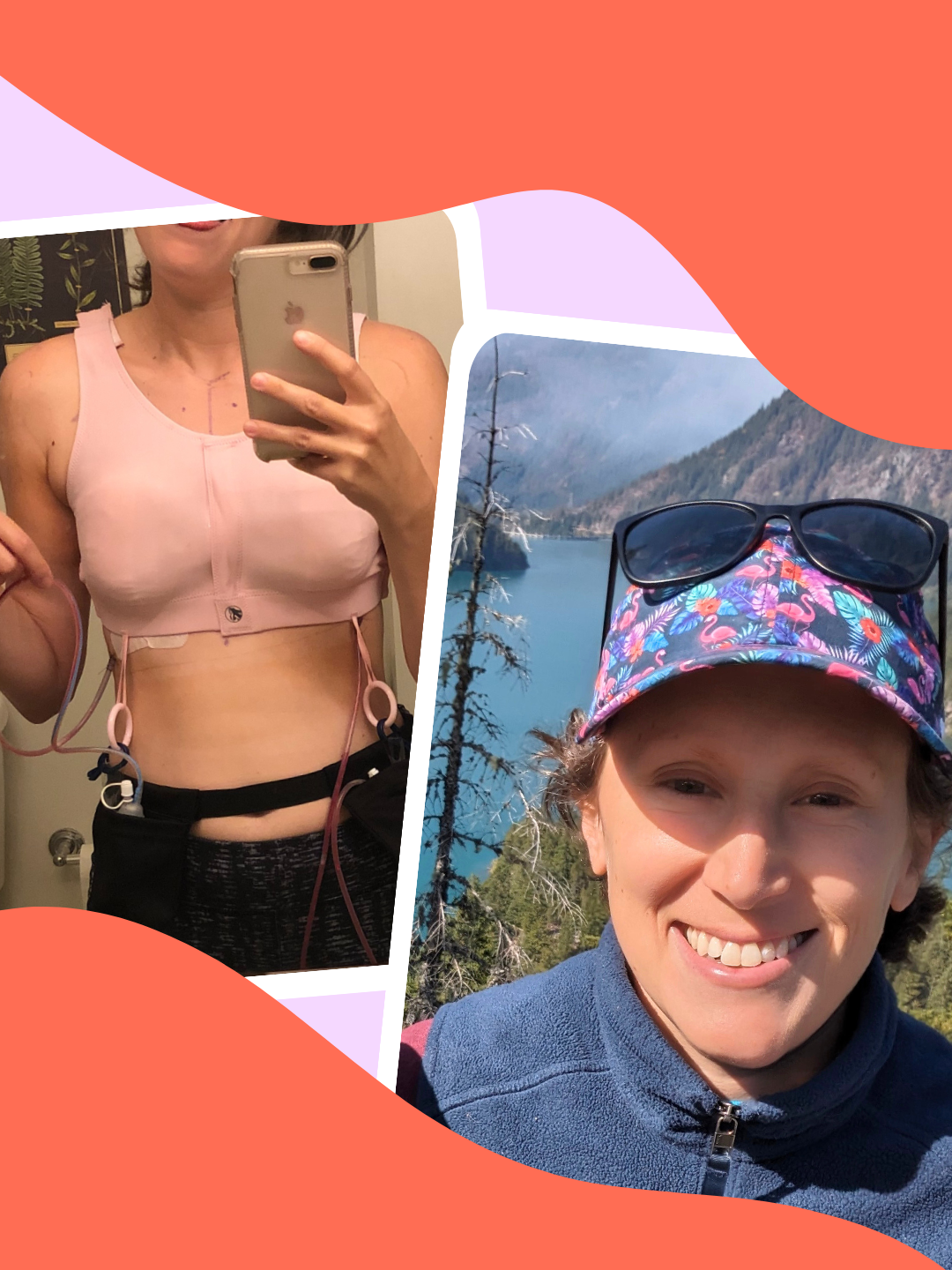 Why A Double Mastectomy Was Right For Me, Even If the Media Says It Wasn’t Necessary